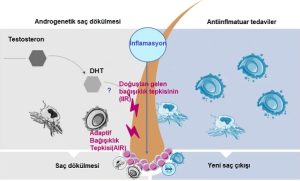 Türkiye'de anti-hair loss tedavileri için dökülme türleri